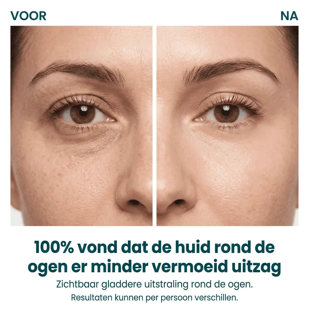 Gel Lifting Instantáneo de Colágeno para Ojos