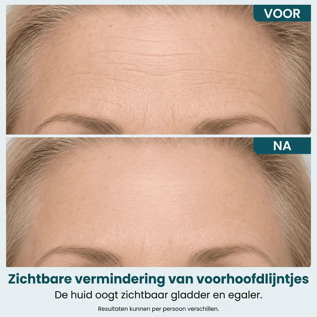 Gel Lifting Instantáneo de Colágeno para Ojos